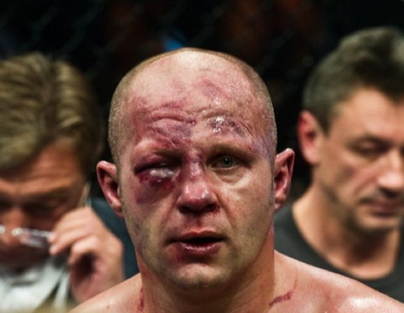 As imagens exclusivas de um Strikeforce histórico