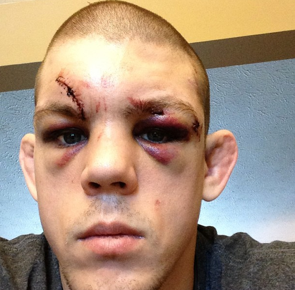 Joe Lauzon Instagram 4