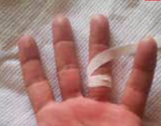 Protect yourself: Tape your fingers like a pro
